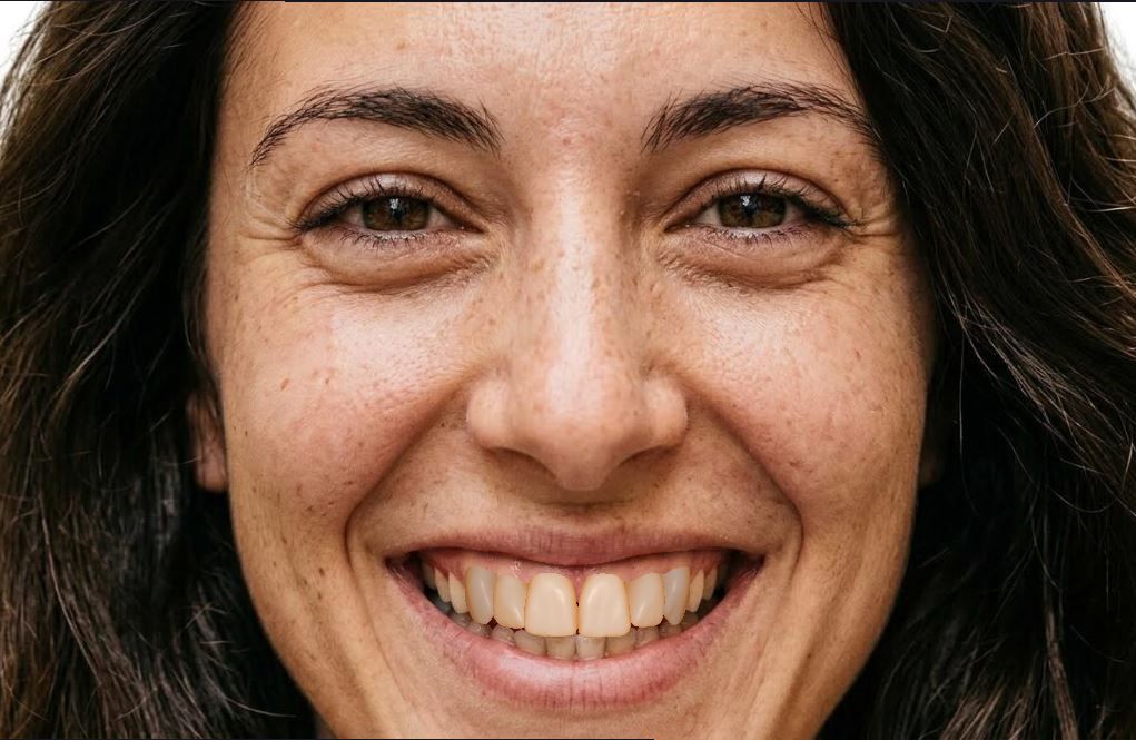 Pianificazione digitale sorriso